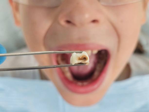 Professional Emergency Dentist in WI